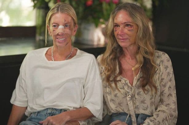 Women 'thought they were going to die' after celebrity dentist's savage random attacks